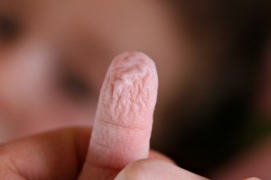 Wrinkly_fingers